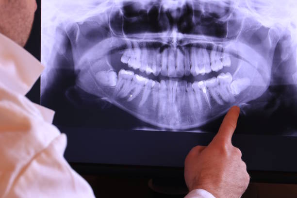 Best Emergency Treatment for Jaw Pain or Injury in Watertown, NY